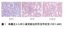 靜脈注射含飽和氫氣生理鹽水減輕小鼠腎臟缺血再灌注損傷