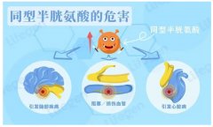 氫氣改善高同型半胱氨酸血癥中的作用及機(jī)制研究