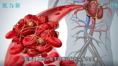 氫氣對心肌梗死的作用