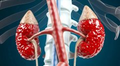 氫氣改善慢性腎臟病患者腎功能和生活質(zhì)量