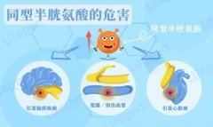氫氣怎么改善高同型半胱氨酸血癥