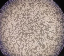 含氫培養(yǎng)液對脂多糖致Raw264.7巨噬細(xì)胞炎癥反應(yīng)的影響
