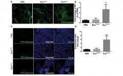 富氫水抑制TGF-β1/α-SMA/Col1α1通路調(diào)控內(nèi)質(zhì)網(wǎng)應(yīng)激改善肺纖維化小鼠肺損傷