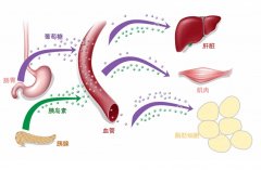 氫分子調(diào)節(jié)2型糖尿病血糖代謝和胰島素抵抗的臨床應(yīng)用與機(jī)制研究
