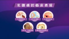 氫氣干預(yù)乳腺癌細(xì)胞的奧秘探索