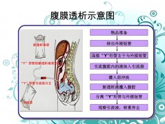 分子氫對(duì)腹膜透析患者超濾功能影響的臨床和機(jī)制研究