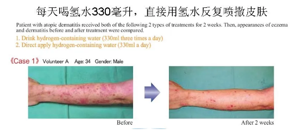 氫氣憑什么如此牛？
