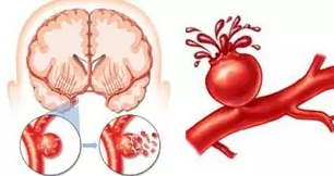 《喝出健康》之氫分子醫(yī)學(xué)知識(shí)，看這一篇就夠了！