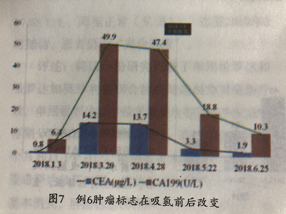卵巢癌手術(shù)后的氫氣輔助改善