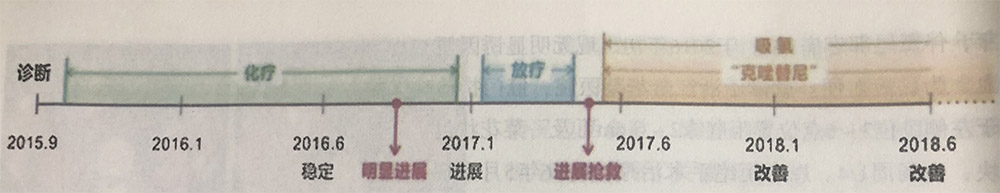 非小細(xì)胞性肺癌伴腦轉(zhuǎn)移