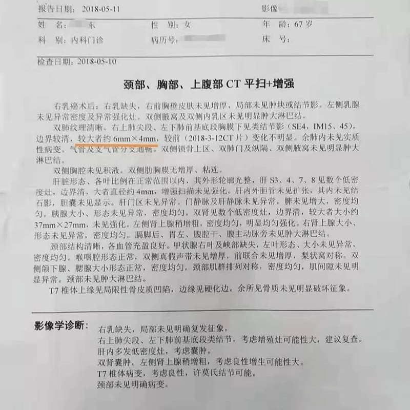 肺結(jié)節(jié)糾結(jié)，吸氫氣釋懷