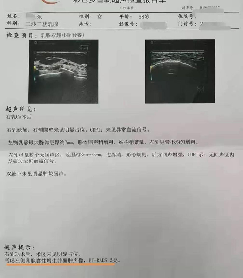 肺結(jié)節(jié)糾結(jié)，吸氫氣釋懷