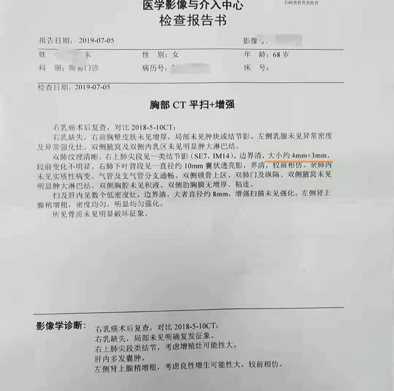 肺結(jié)節(jié)糾結(jié)，吸氫氣釋懷