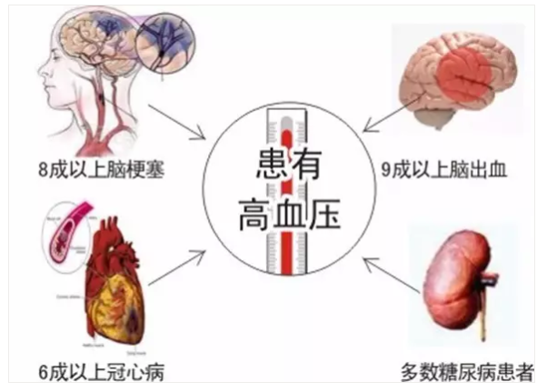 氫氣與高血壓