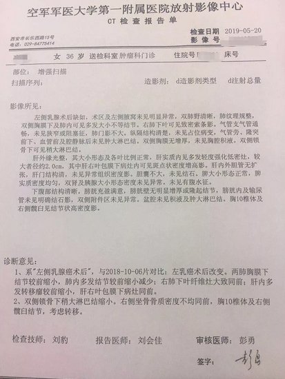全身多發(fā)轉(zhuǎn)移，吸氫兩個(gè)月，她的轉(zhuǎn)移瘤縮小減少了！