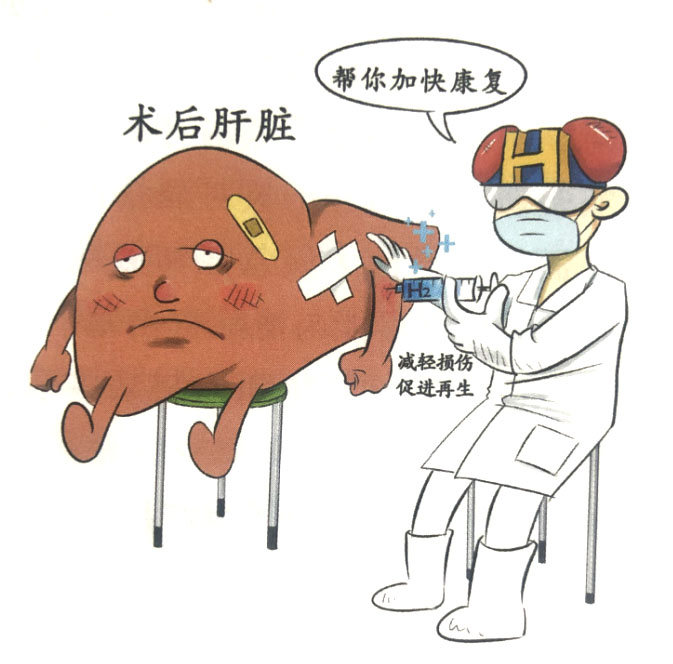 分子氫對(duì)肝臟的保護(hù)作用
