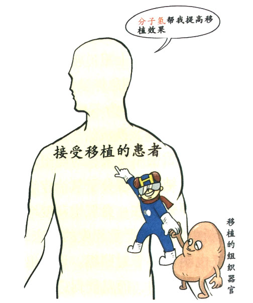 分子氫在器官移植保護方面的作用