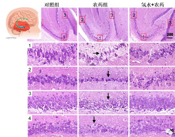 氫氣生物學(xué)機(jī)理:氫氣與乙酰膽堿酯酶