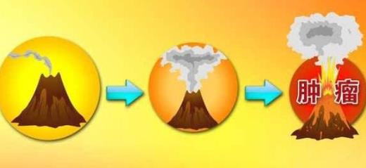 研究癌癥一輩子，院士為何勸人別輕易開刀？！氫閱讀
