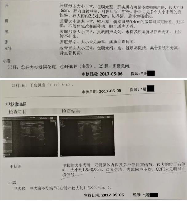 囊腫、息肉、結(jié)節(jié)，喝氫水都有效果