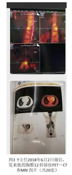 兩位醫(yī)學(xué)專家自己用氫氣改善病的故事