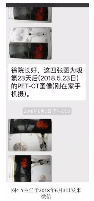 兩位醫(yī)學(xué)專家自己用氫氣改善病的故事