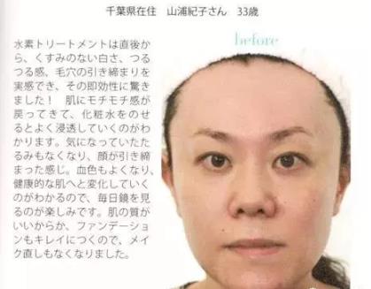 《水素的力量》氫水美容護(hù)膚減肥見奇跡