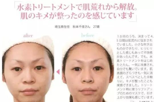 《水素的力量》氫水美容護(hù)膚減肥見奇跡