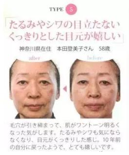 《水素的力量》氫水美容護(hù)膚減肥見奇跡
