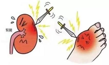 尿酸高？那你就離不開氫了！