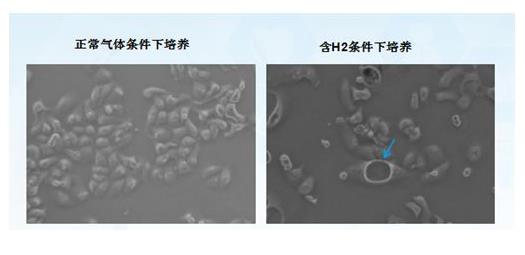 氫改善癌癥：他患肝癌，改善很順暢