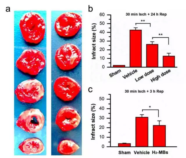 中國科學(xué)院：納米氫氣泡能改善心臟缺血