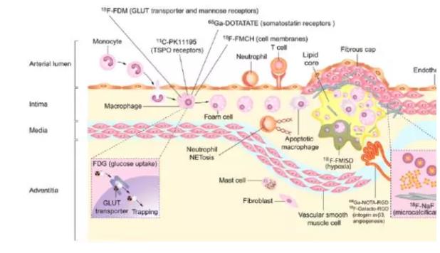 應(yīng)激誘發(fā)心血管事件，氫氣或可挽救生命