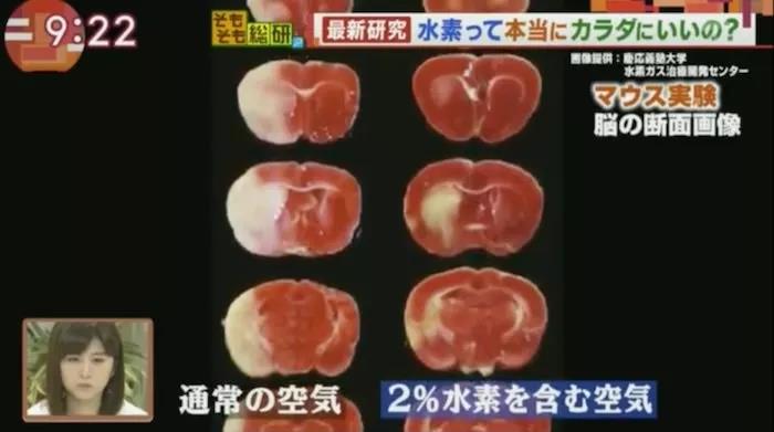 吸入氫氣的小老鼠，腦梗塞部分減少約一半