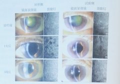 “氫”眼所見：氫分子與眼部疾病
