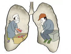 速看！氫醫(yī)學(xué)對(duì)肺結(jié)核患者的影響