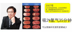 氫分子促進(jìn)健康的4大特點(diǎn) ！