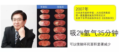 氫分子促進健康的4大生物學效應，看這篇就夠了！