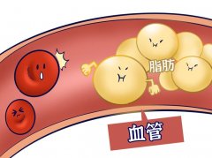 氫氣對高血脂有什么作用？氫氣對高血脂的研究概述
