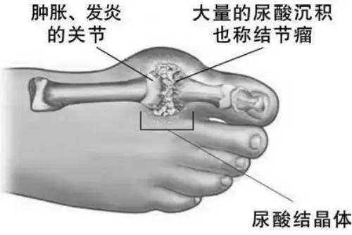 氫氣醫(yī)學(xué)研究論文_醫(yī)學(xué)論文氫氣研究方法_醫(yī)學(xué)論文氫氣研究方向